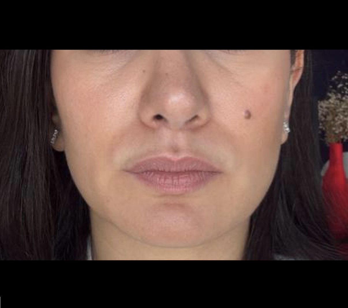 Avant full face cas 3