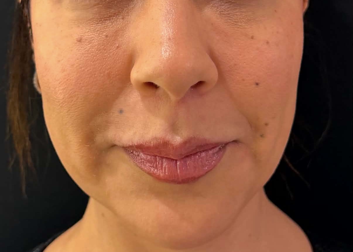 Avant full face cas 4